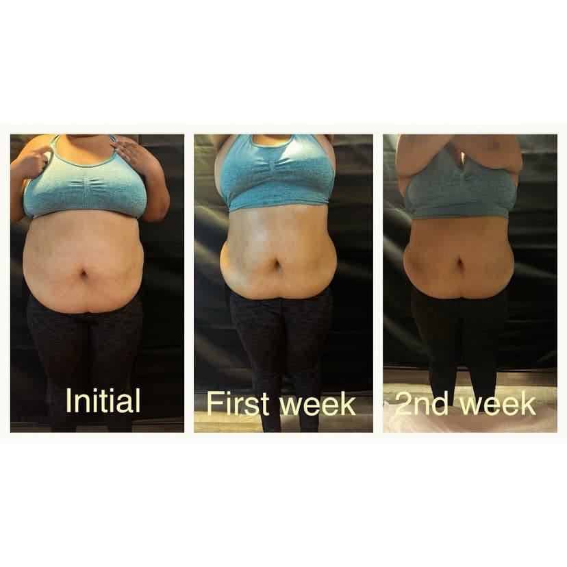 Snatched & Sculpted Results Image 1